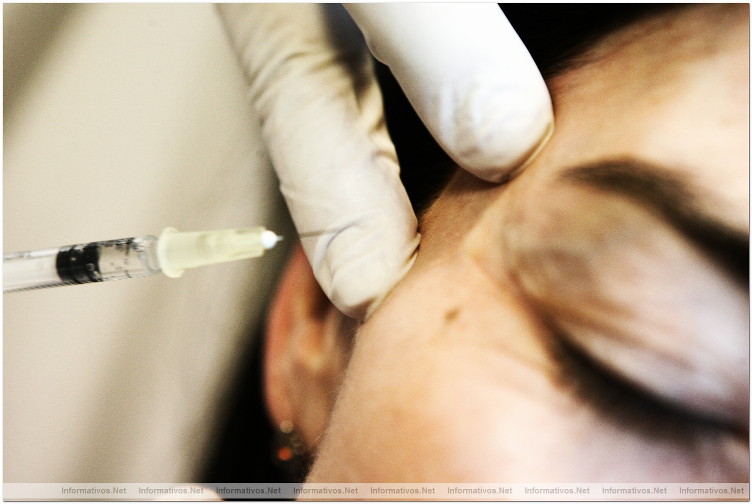 La hyaloescultura es un tratamiento con un alto grado de satisfacci�n entre los pacientes, con resultados inmediatos y muy naturales